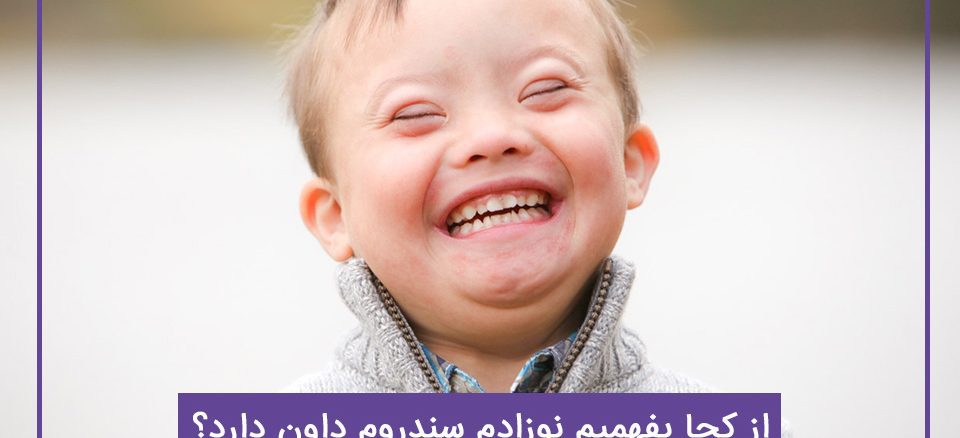 از کجا بفهمیم نوزادم سندروم داون دارد؟