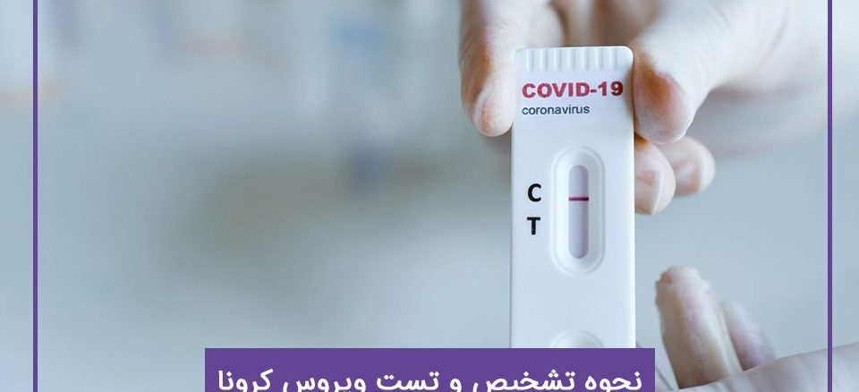 شرایط و تشخیص ویروس کرونا در آزمایشگاه تهران لب