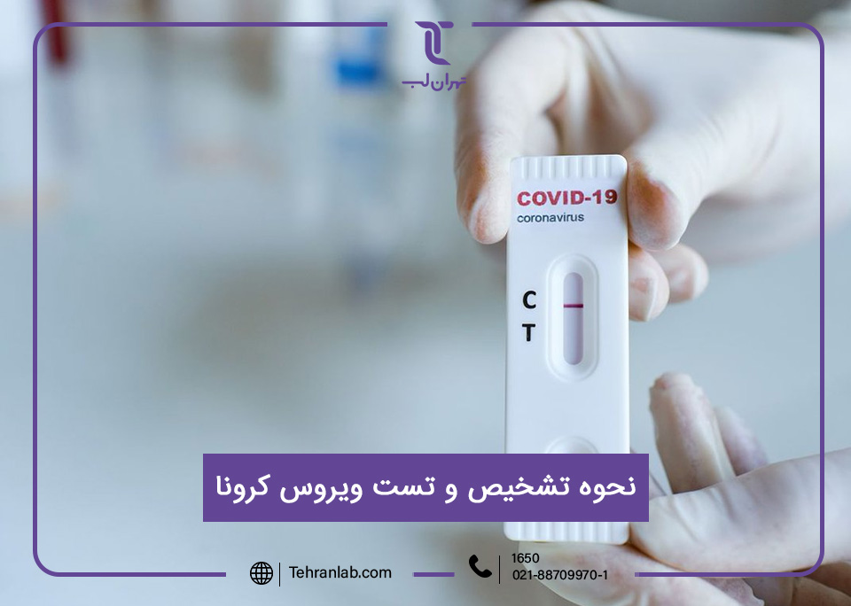 شرایط و تشخیص ویروس کرونا در آزمایشگاه تهران لب
