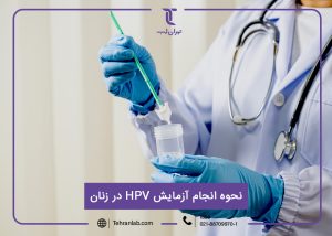 آزمایش HPV زنان (نحوه آزمایش hpv در زنان)
