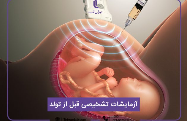 آزمایشات تشخیصی قبل از تولد