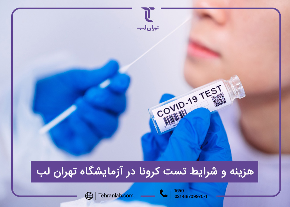 هزینه تست کرونا و نمونه گیری ویروس کرونا در آزمایشگاه تهران لب