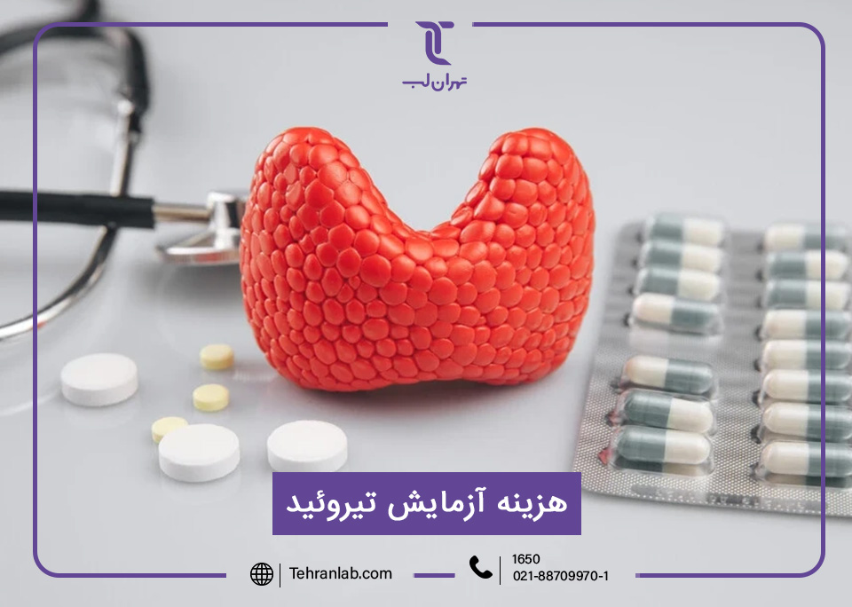 هزینه آزمایش تیروئید
