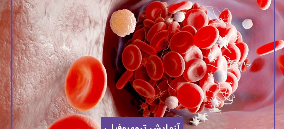 آزمایش ترومبوفیلی