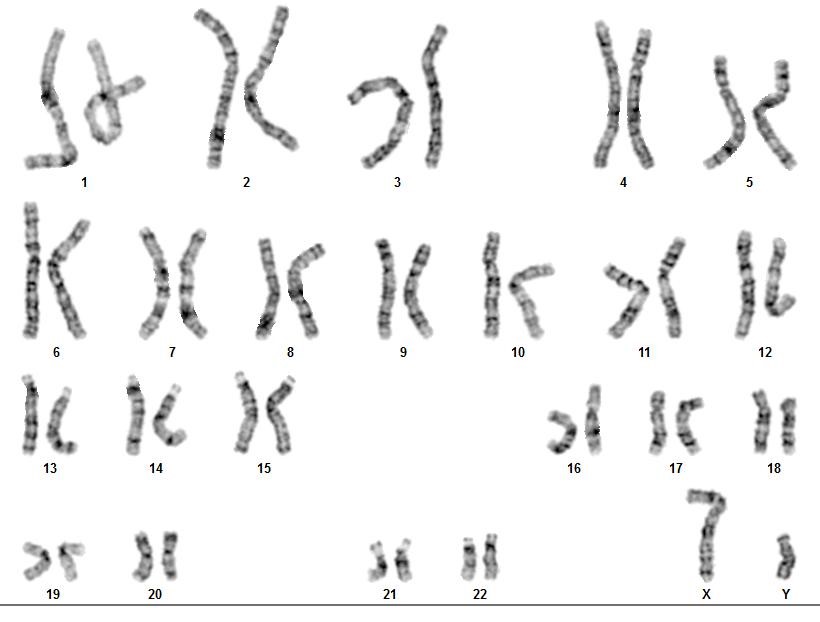 عکس جواب آمنیوسنتز نرمال