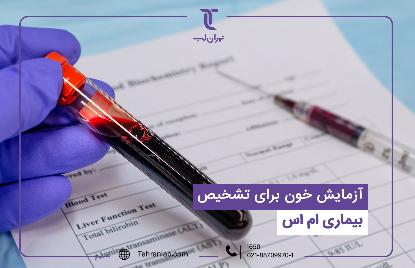 آزمایش خون برای تشخیص بیماری ام اس