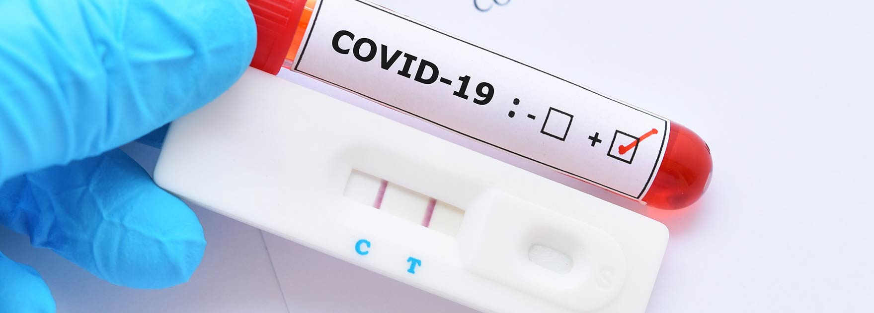تست کرونا (کووید 19) در منزل