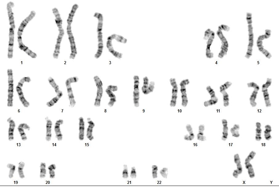 نمونه جواب آزمایش کاریوتایپ