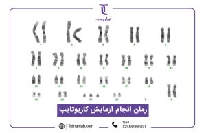 زمان انجام آزمایش کاریوتایپ
