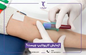 آزمایش کاریوتایپ (تست سیتوژنتیک در آزمایشگاه تهران لب) + شرایط