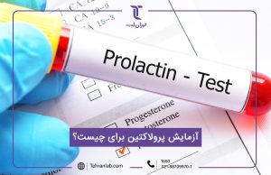 آزمایش پرولاکتین برای چیست؟ + قیمت و شرایط انجام آزمایش پرولاکتین