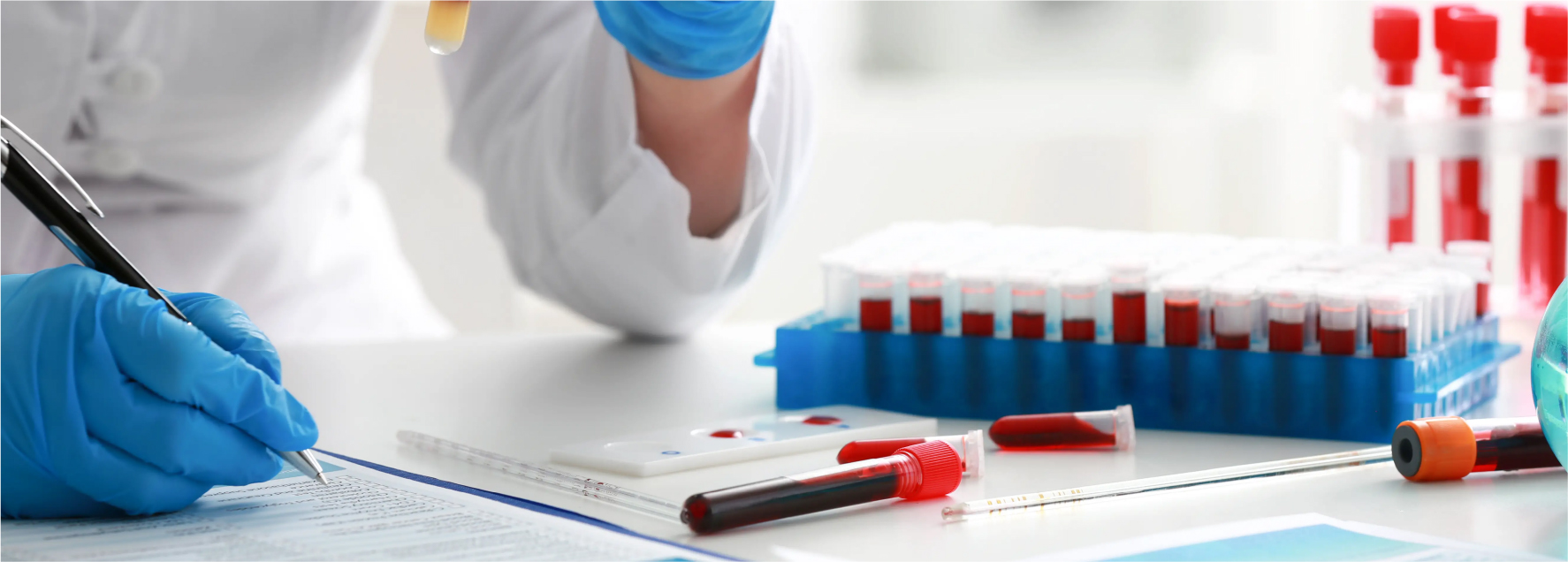آزمایش خون و فاکتورهایی که در منزل در آن بررسی میشود