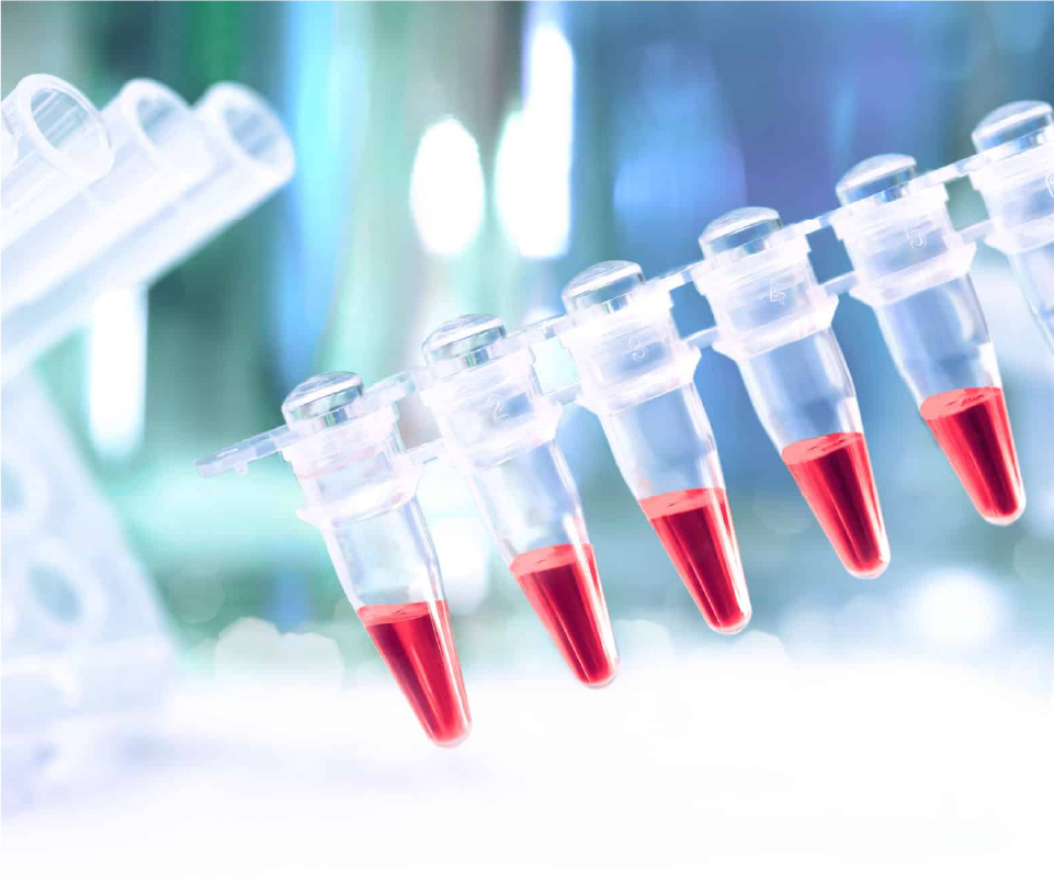 احتمال تشخیص انواع بیماری با آزمایش HPV
