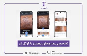 توانایی گوگل در تشخیص بیماری های پوستی تنها با یک اسکن ساده