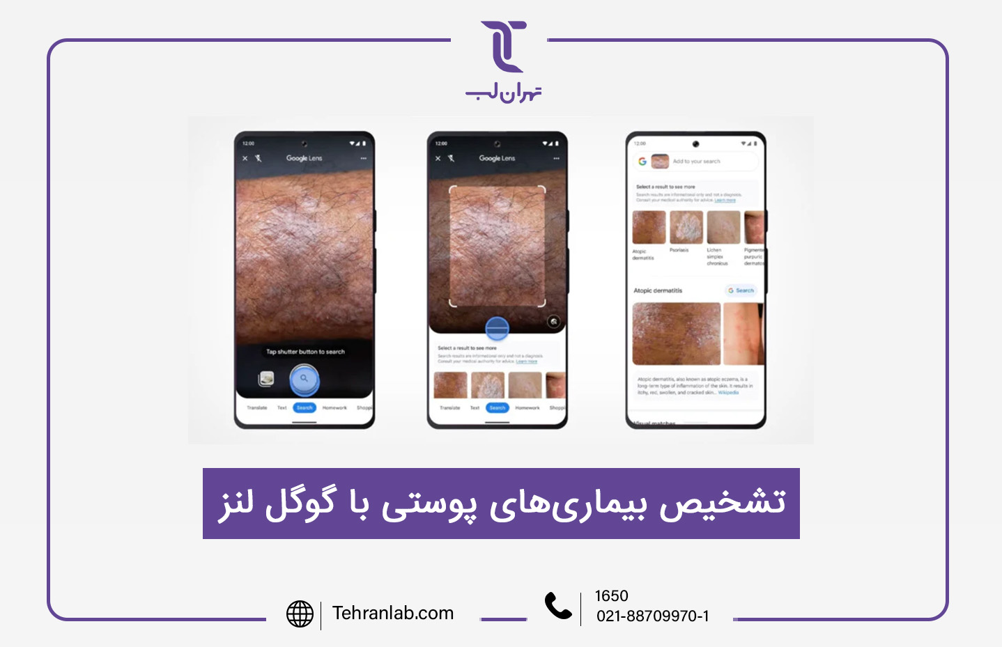 توانایی گوگل در تشخیص بیماری های پوستی تنها با یک اسکن ساده