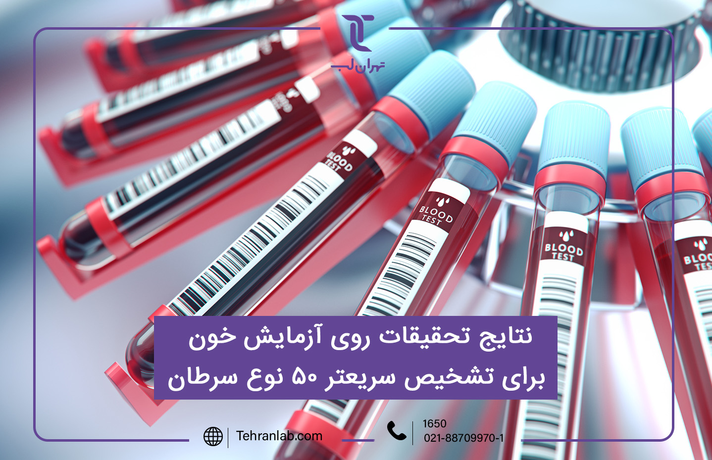 نتایج تحقیقات روی آزمایش خون برای تشخیص سریعتر 50 نوع سرطان