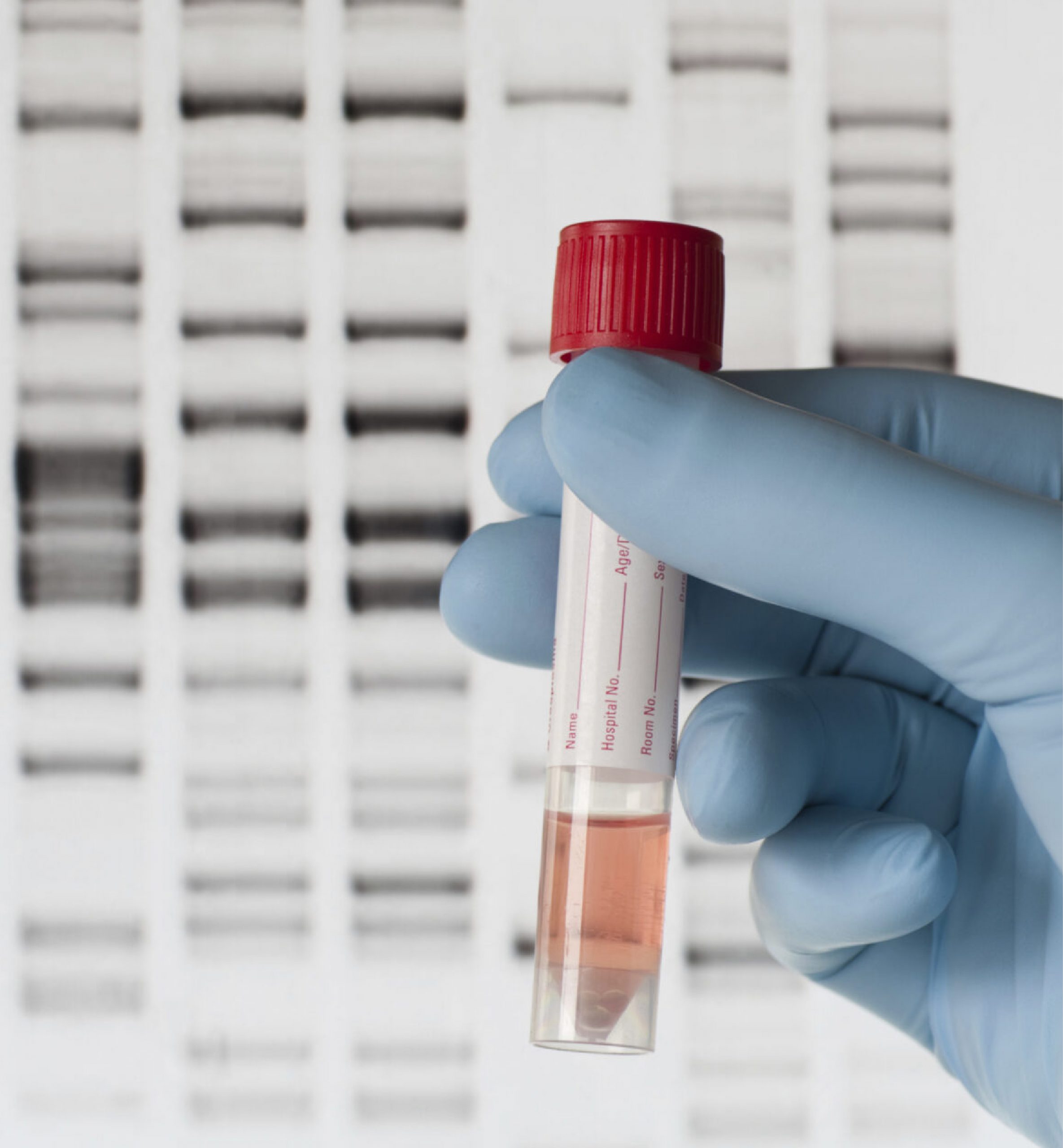 تست DNA (آزمایش تعیین هویت و تشخیص هویت)