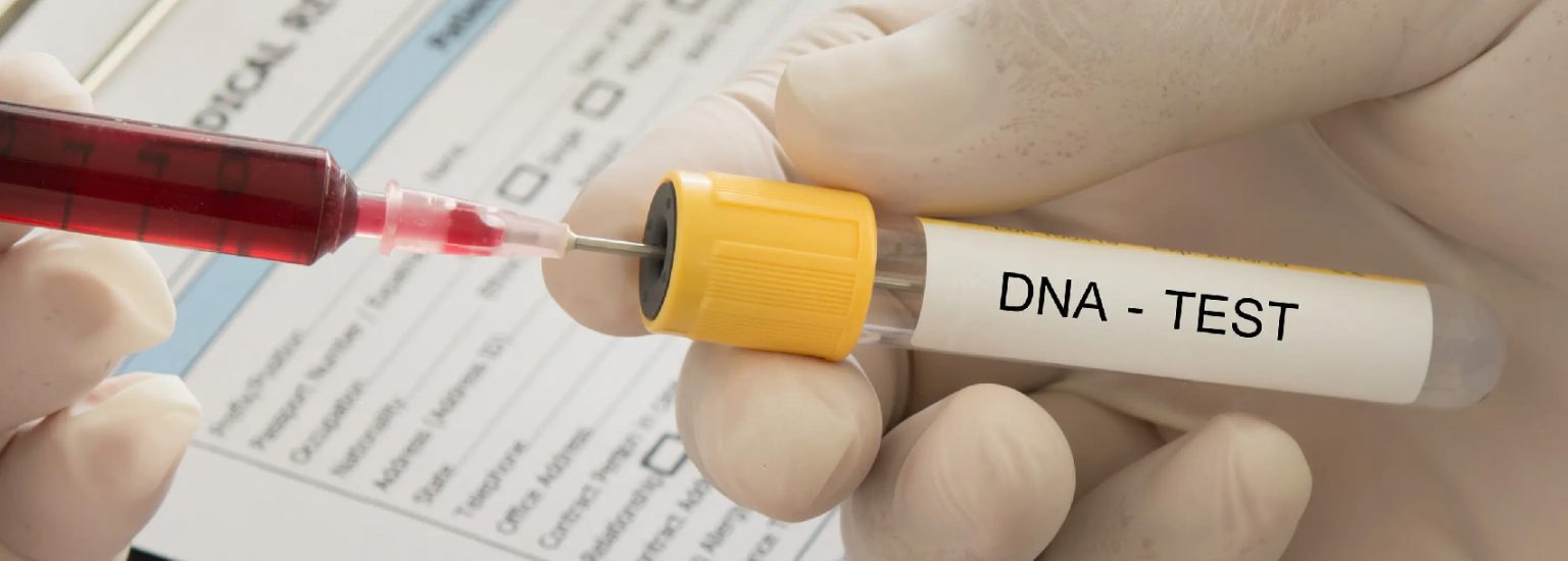 تست DNA آزمایش تشخیص هویت (تعیین هویت)