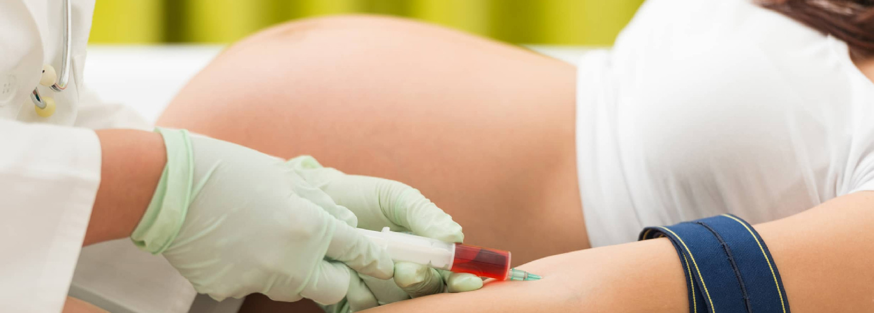 انواع تست DNA بارداری در غربالگری 