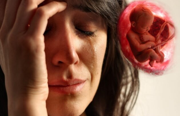 سقط جنین | انواع، دلایل، علائم، قرص‌ها، پیشگیری