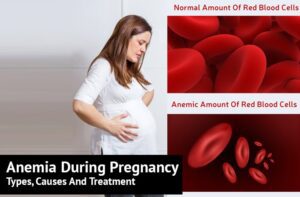 کم خونی در بارداری | علت، عوارض، درمان