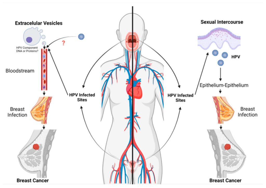 آیا ارتباطی بین ویروس HPV و سرطان سینه وجود دارد؟ چه بررسی هایی انجام شده است؟