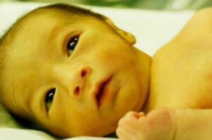 زردی نوزاد چیست؟ | علائم، تشخیص، عوارض، درمان