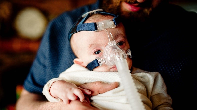 عوامل خطر تریزومی ۱۳ (سندروم پاتو) چیست؟