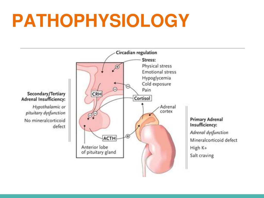 علت اختلال آدیسون چیست؟