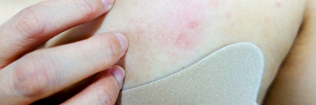 بررسی علائم و تشخیص تغییر پوست روی سینه و پستان