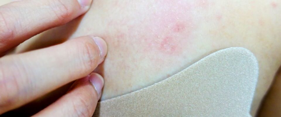 بررسی علائم و تشخیص تغییر پوست روی سینه و پستان