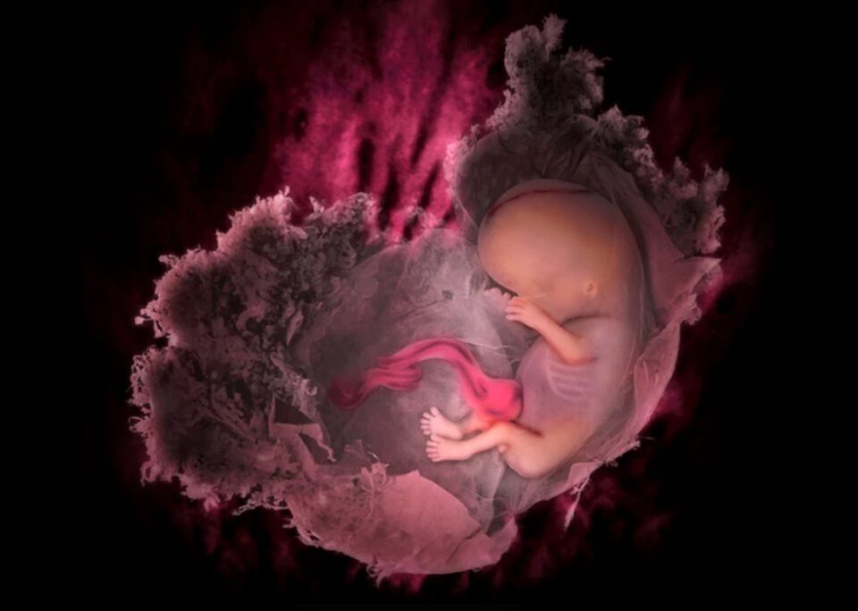 recurrent-pregnancy-loss- سقط مکرر