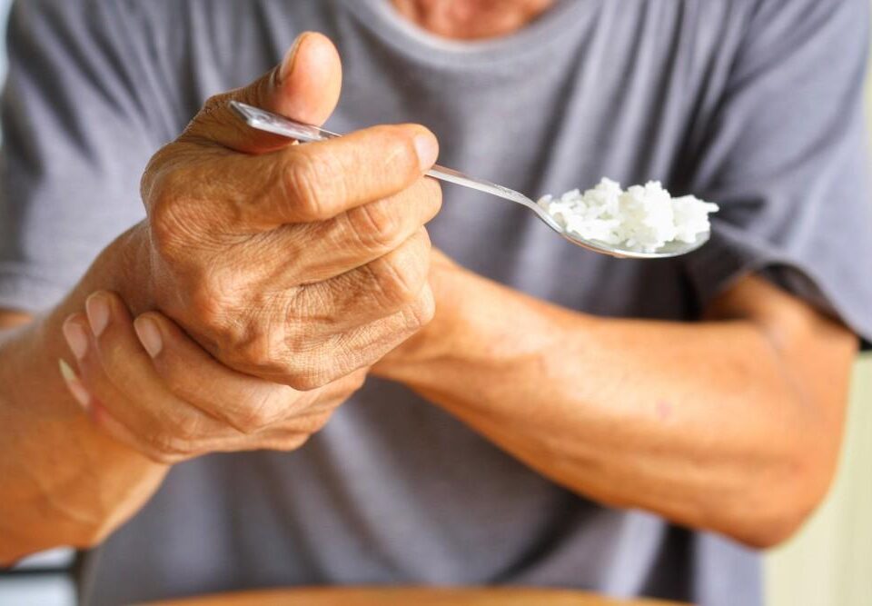 بیماری پارکینسون چیست؟ |  علت، علائم، تشخیص و درمان پارکینسون