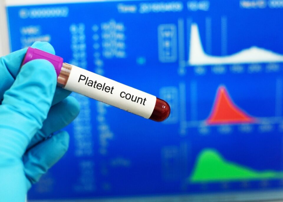 آزمایش PLT و تفسیر آن