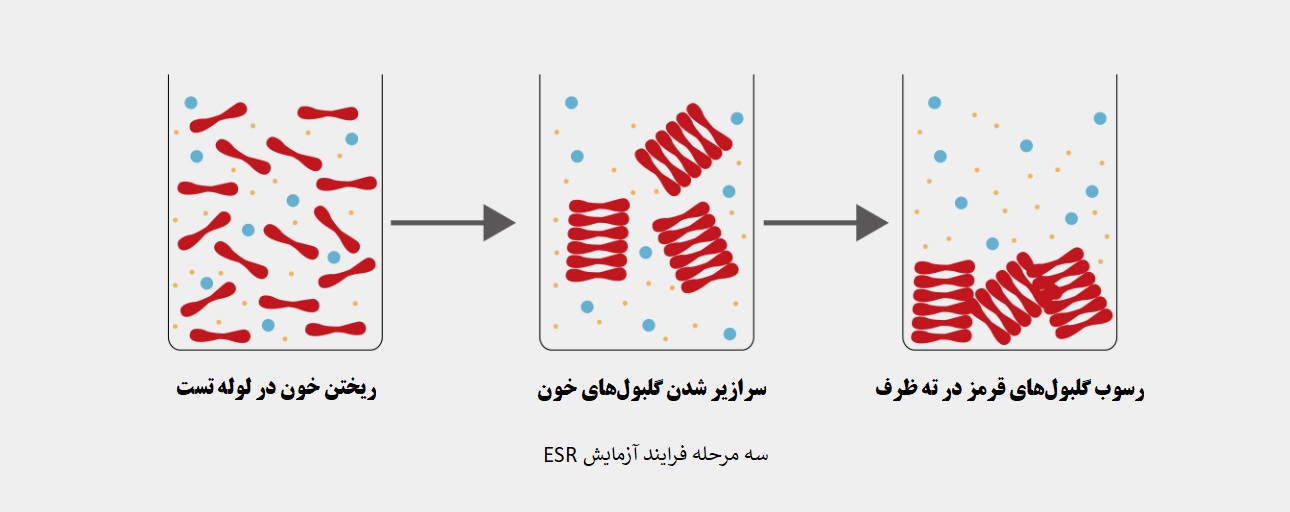 رسوب گلبول های قرمز خون