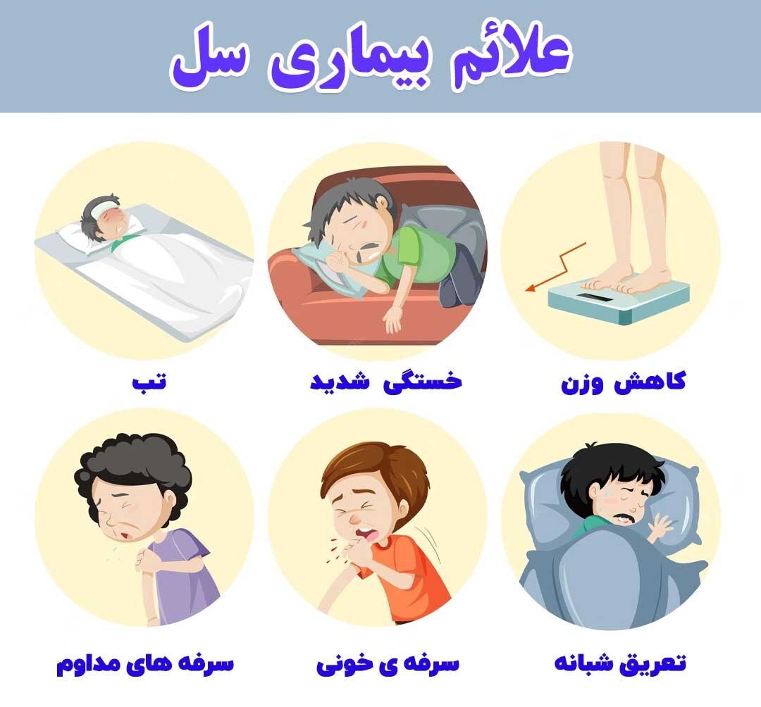 علائم بیماری سل