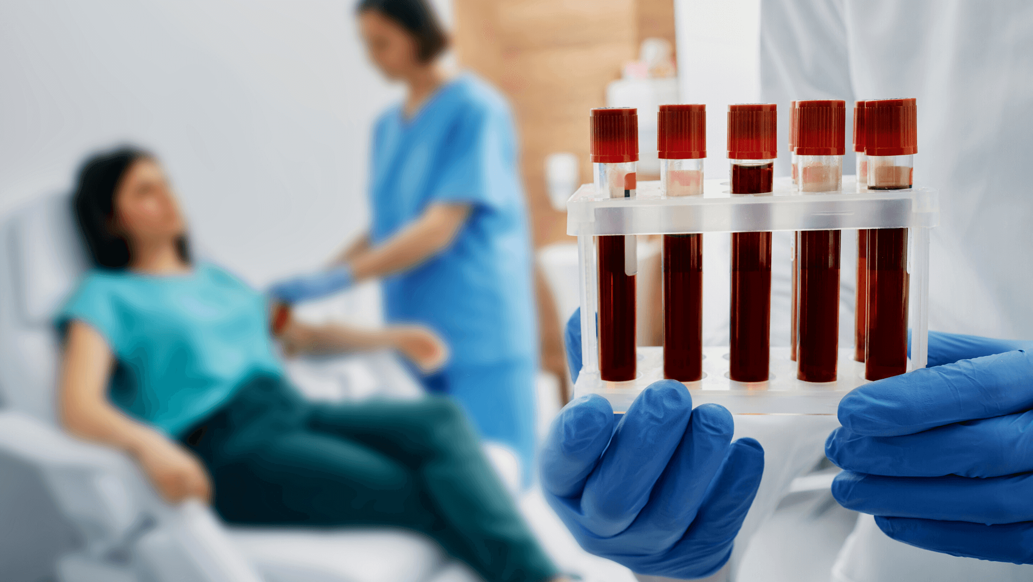 فرایند آزمایش platelets