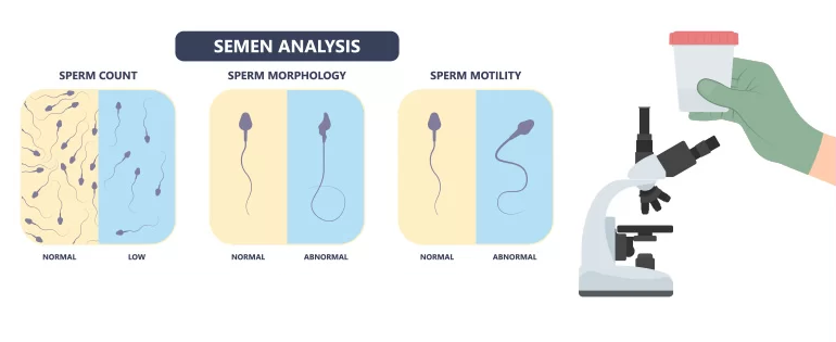 آزمایش اسپرم چیست؟