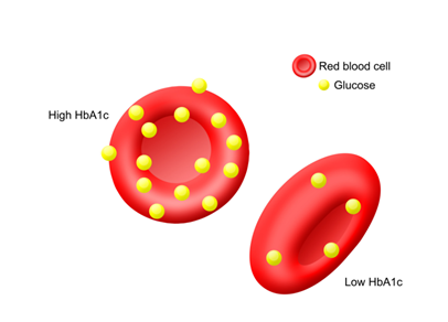 A1C