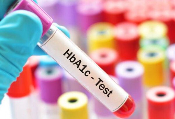 آزمایش HbA1C