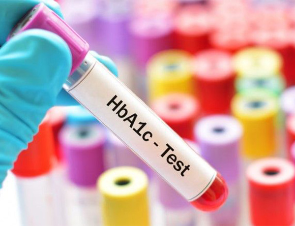 آزمایش HbA1C