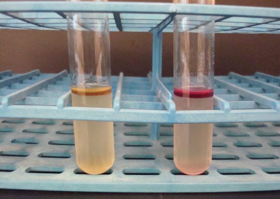 تست ایندول (Indole test)