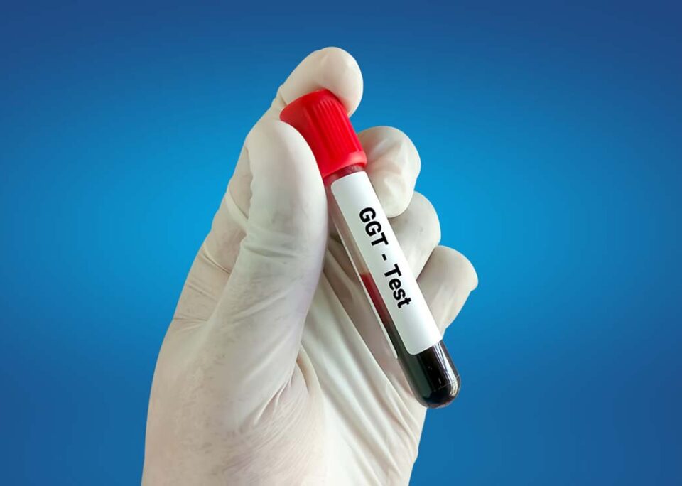 آزمایش گاما گلوتامیل ترانسفراز (GGT)