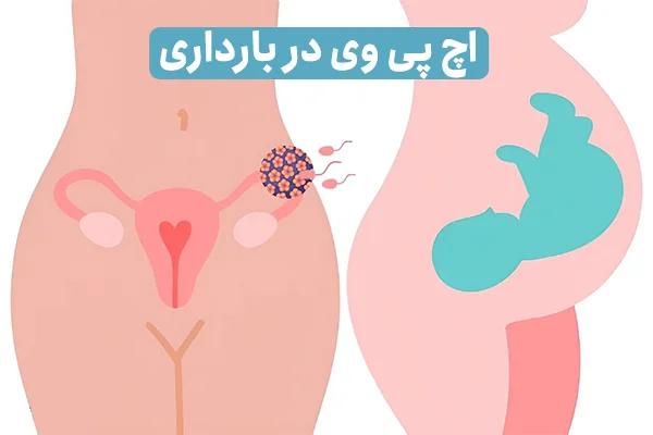 انتقال ویروس hpv در بارداری به جنین