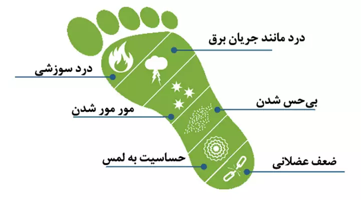 علائم نوروپاتی محیطی