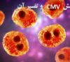 آزمایش CMV چیست؟