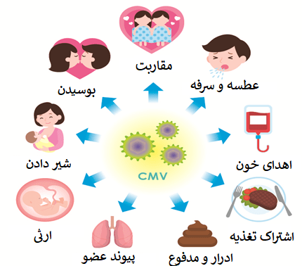 انتقال CMV