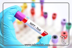 آزمایش سل فری (NIPT)