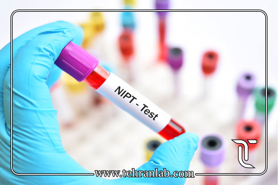 آزمایش سل فری (NIPT)