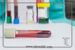 آزمایش AFP یا CA 19-9